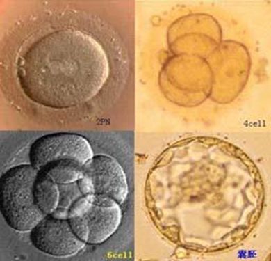 图三:试管婴儿的模样—胚胎在体外培养的过程
