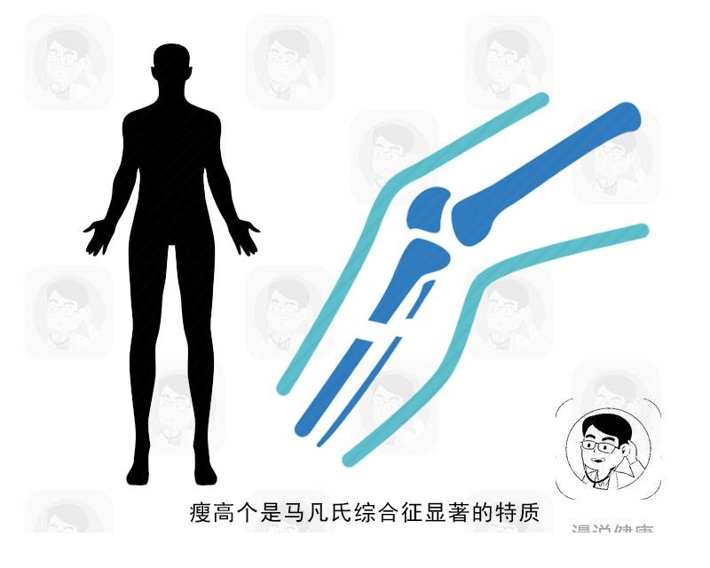 大长腿让人羡慕?若同时出现这3个现象,建议你及时去做检查