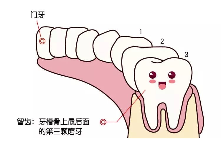 京医通智齿出现这6种情况疼不疼都必须拔