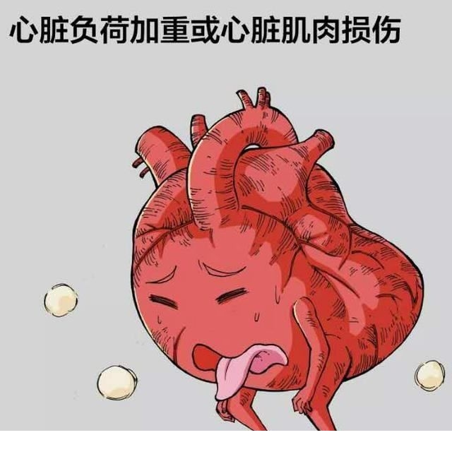 后心脏收缩力显著减弱且不协调,故在起病最初几天易发生急性左心衰竭